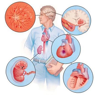 Cardiol impide o desenvolvemento de comorbilidades